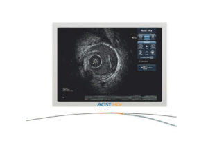 Intravascular Ultrasound Guided PCI | HDi HD IVUS & Catheter System ...