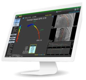 Intravascular Ultrasound Guided PCI | HDi HD IVUS & Catheter System ...